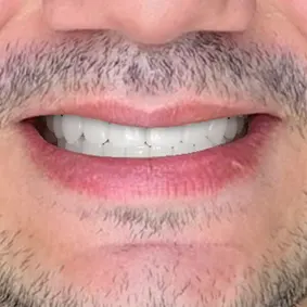 Zâmbet cu Smile Test Drive