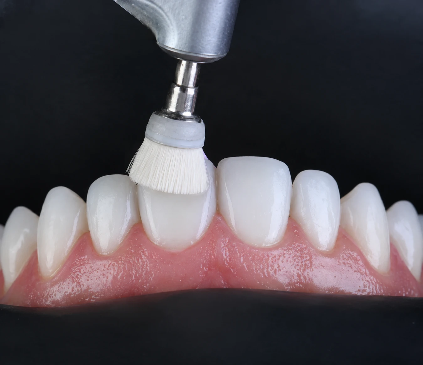 Igienizare dentară profesională