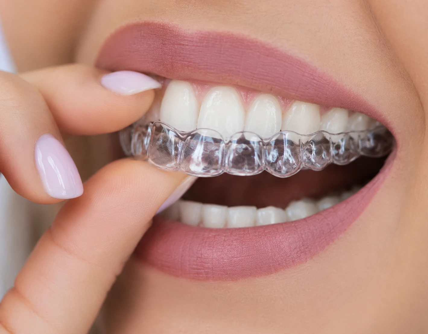 Ortodonție la clinica 3Dental