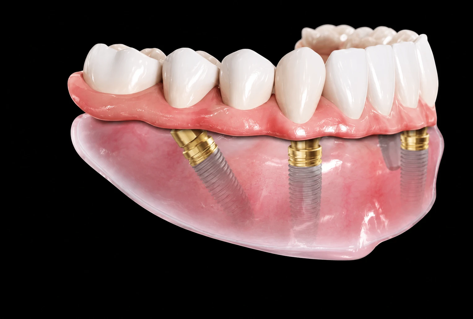 Chirurgie orală